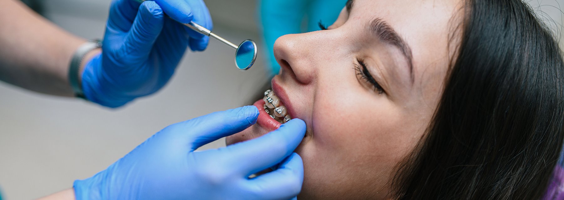 Treatment Info